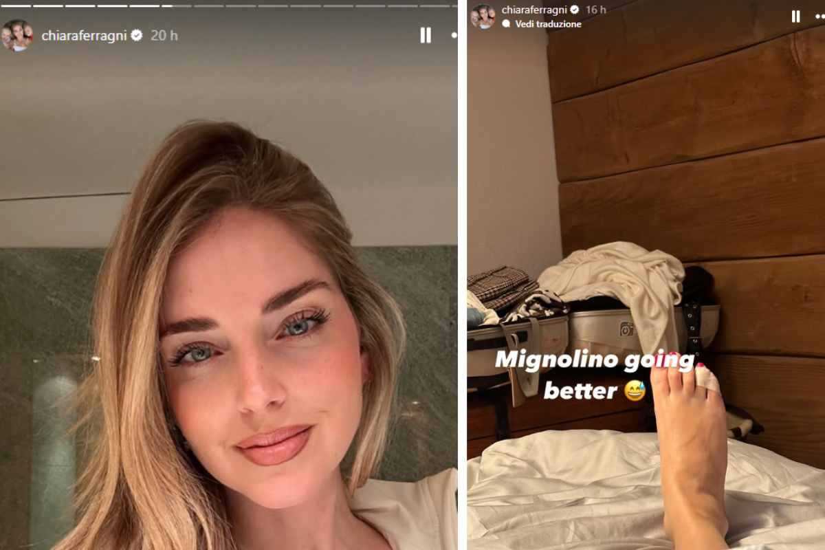 infortunio chiara ferragni